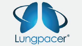 Lungpacer